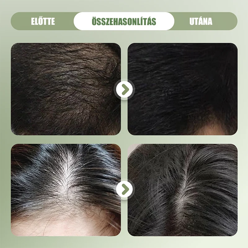 🌿 Naravni trd šampon za krepitev las 🌱🥰--SI