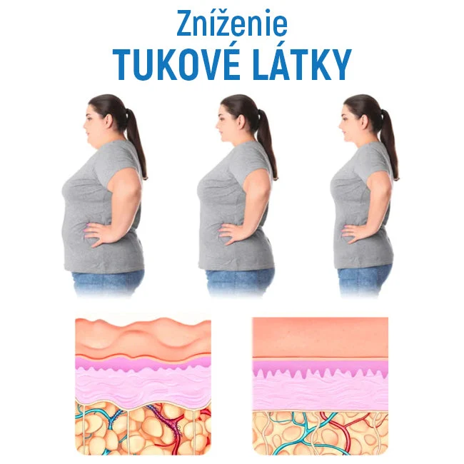 ✨Osta üks ja saad ühe tasuta✨ keha vormiv aluspesu